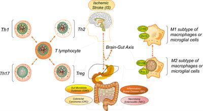 Cellular Immune Signal Exchange From Ischemic Stroke to Intestinal Lesions Through <mark class="highlighted">Brain-Gut</mark> Axis